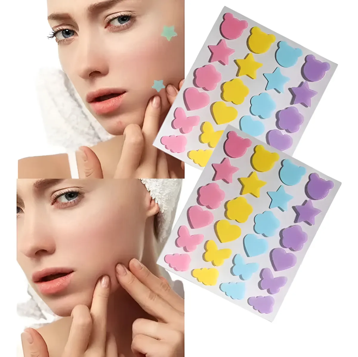 Miniatura 3 de Parches para granitos Acne Patch Charm Limit